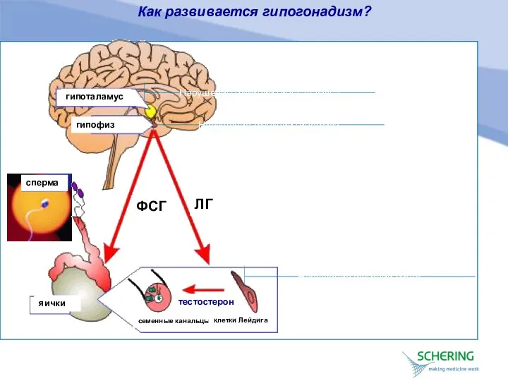 Как развивается гипогонадизм? гипоталамус гипофиз сперма ФСГ ЛГ яички семенные канальцы