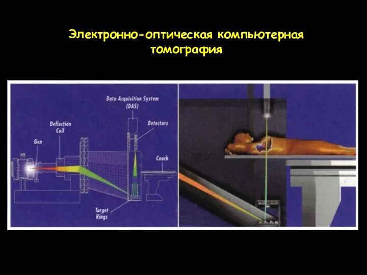 Электронно-оптическая компьютерная томография