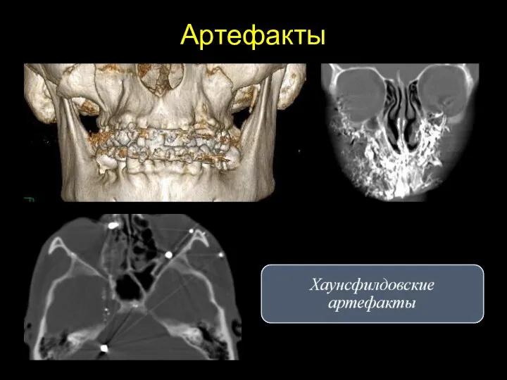 Артефакты