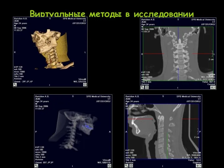 Виртуальные методы в исследовании