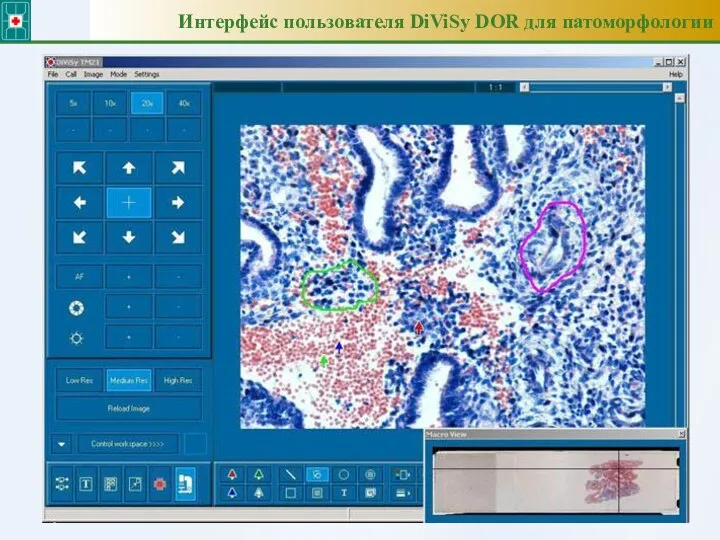 Интерфейс пользователя DiViSy DOR для патоморфологии