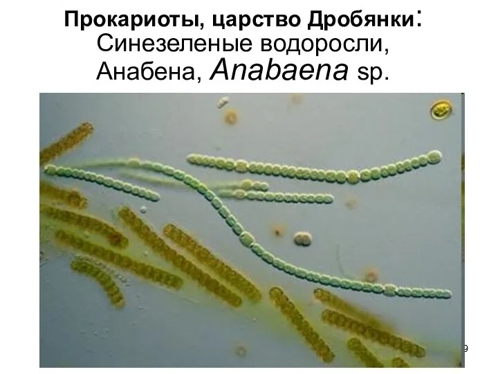 Прокариоты, царство Дробянки: Синезеленые водоросли, Анабена, Anabaena sp.