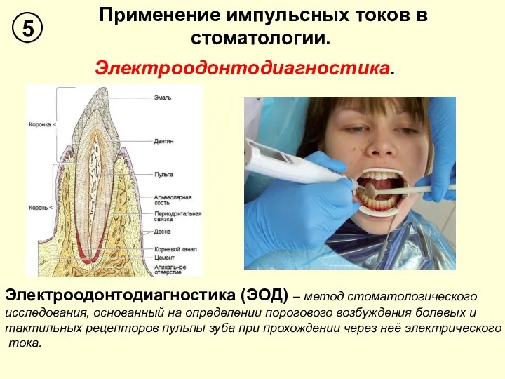 Применение импульсных токов в стоматологии. 5 Электроодонтодиагностика. Электроодонтодиагностика (ЭОД) – метод