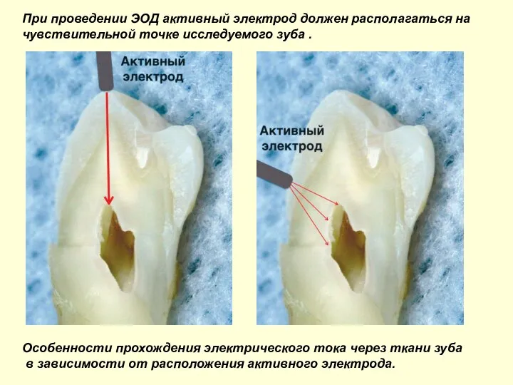 Особенности прохождения электрического тока через ткани зуба в зависимости от расположения