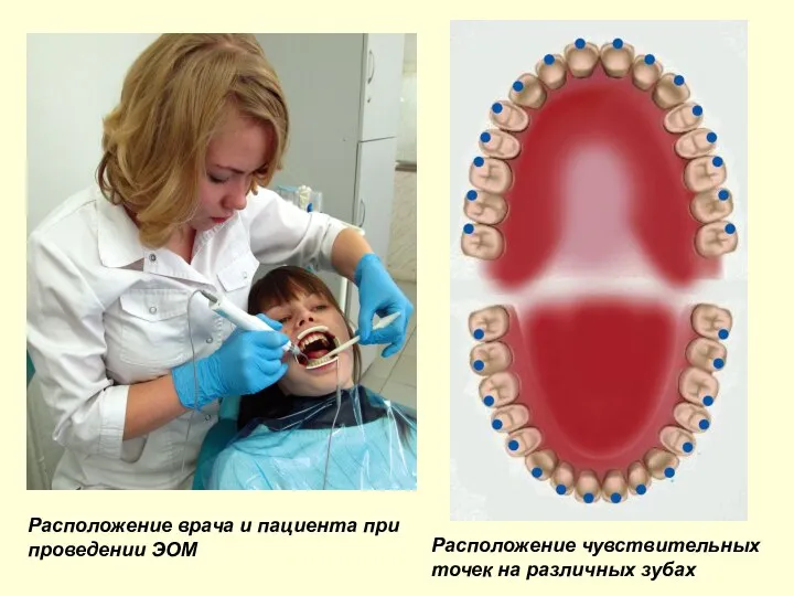 Расположение чувствительных точек на различных зубах Расположение врача и пациента при проведении ЭОМ