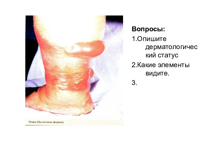 Вопросы: 1.Опишите дерматологический статус 2.Какие элементы видите. 3.