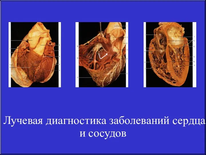 Лучевая диагностика заболеваний сердца и сосудов