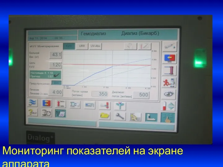 Мониторинг показателей на экране аппарата