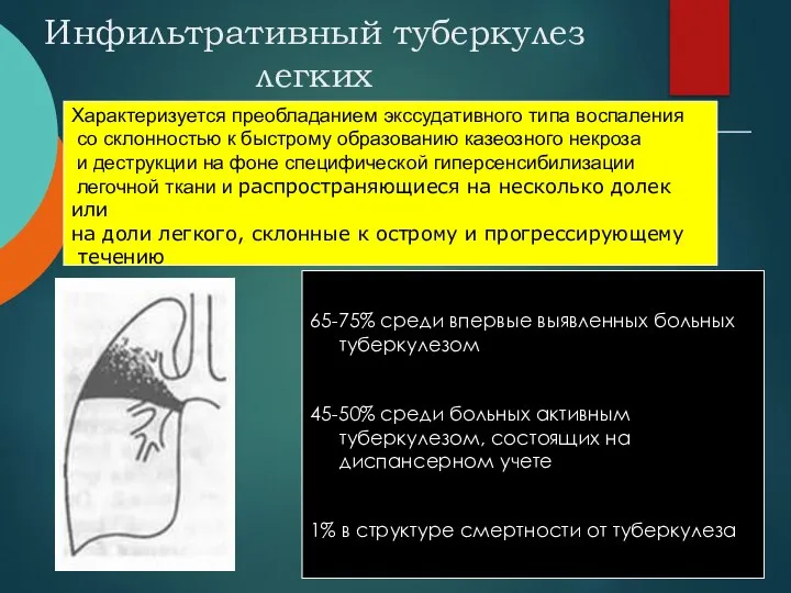 Характеризуется преобладанием экссудативного типа воспаления со склонностью к быстрому образованию казеозного