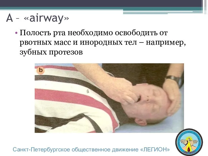 A – «airway» Полость рта необходимо освободить от рвотных масс и