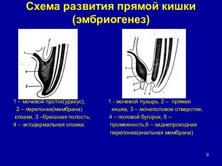 Схема развития прямой кишки(эмбриогенез) 1 – мочевой проток(урахус), 1 - мочевой