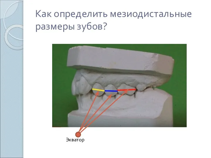 Как определить мезиодистальные размеры зубов? Экватор