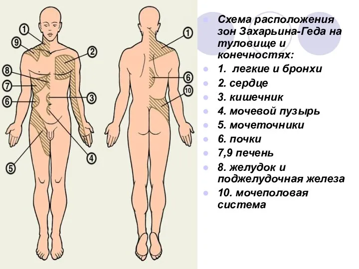 Схема расположения зон Захарьина-Геда на туловище и конечностях: 1. легкие и