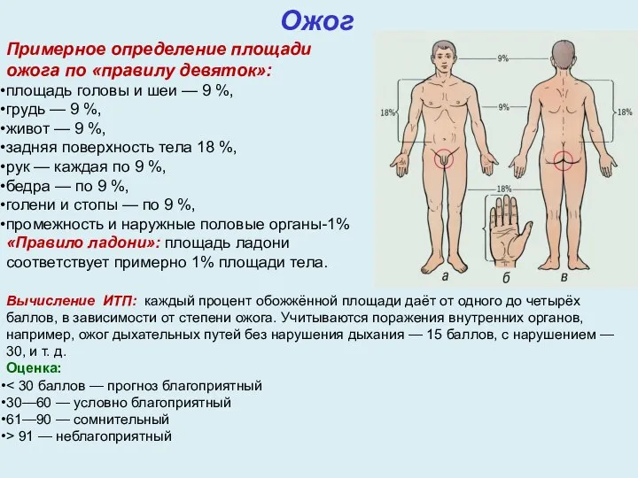 Примерное определение площади ожога по «правилу девяток»: площадь головы и шеи