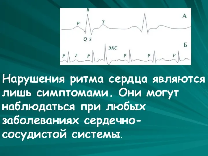 Аритмии Нарушения ритма сердца являются лишь симптомами. Они могут наблюдаться при любых заболеваниях сердечно-сосудистой системы.