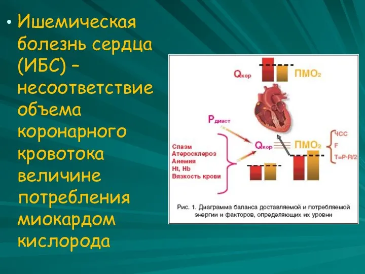 Ишемическая болезнь сердца (ИБС) – несоответствие объема коронарного кровотока величине потребления миокардом кислорода