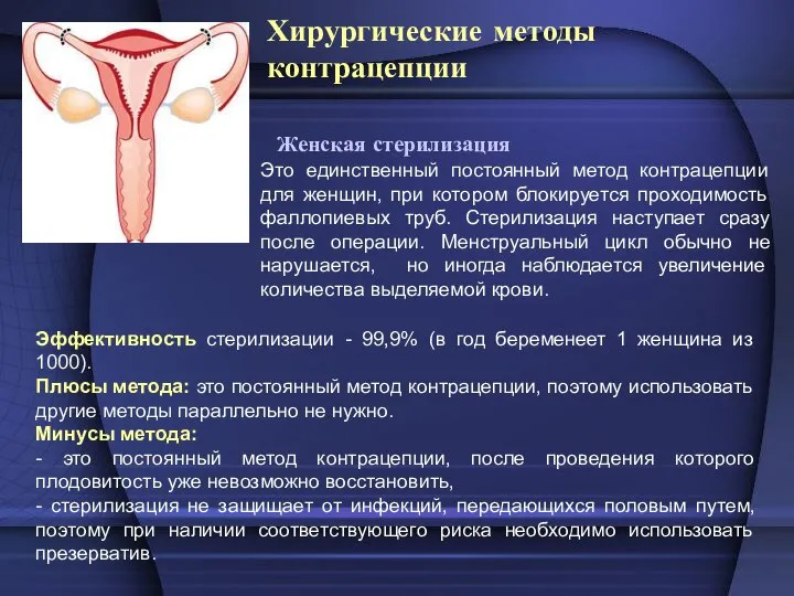 Хирургические методы контрацепции Женская стерилизация Эффективность стерилизации - 99,9% (в год