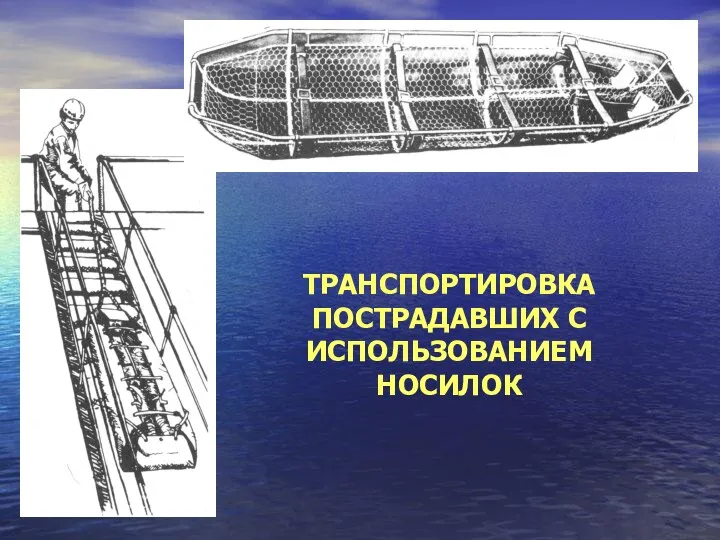 ТРАНСПОРТИРОВКА ПОСТРАДАВШИХ С ИСПОЛЬЗОВАНИЕМ НОСИЛОК