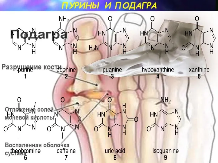 ПУРИНЫ И ПОДАГРА