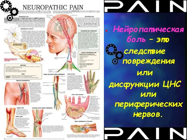 Нейропатическая боль – это следствие повреждения или дисфункции ЦНС или периферических нервов.