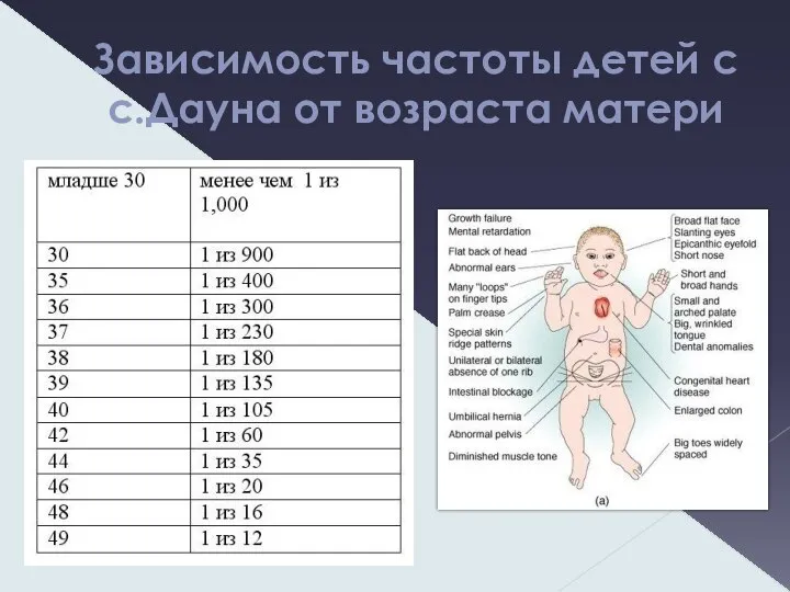 Зависимость частоты детей с с.Дауна от возраста матери