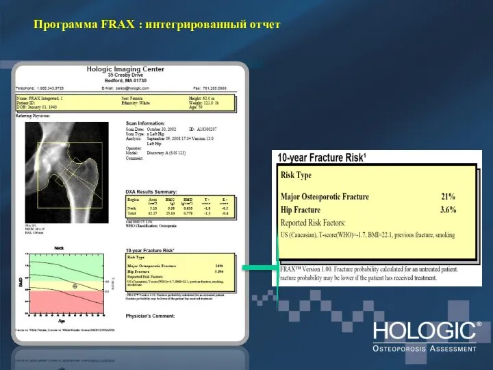 Программа FRAX : интегрированный отчет
