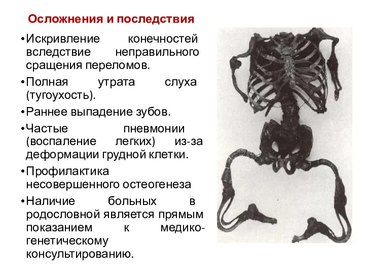 Осложнения и последствия Искривление конечностей вследствие неправильного сращения переломов. Полная утрата