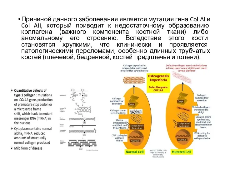 Причиной данного заболевания является мутация гена Col AI и Col AII,