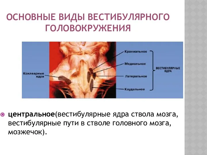 ОСНОВНЫЕ ВИДЫ ВЕСТИБУЛЯРНОГО ГОЛОВОКРУЖЕНИЯ центральное(вестибулярные ядра ствола мозга, вестибулярные пути в стволе головного мозга, мозжечок).