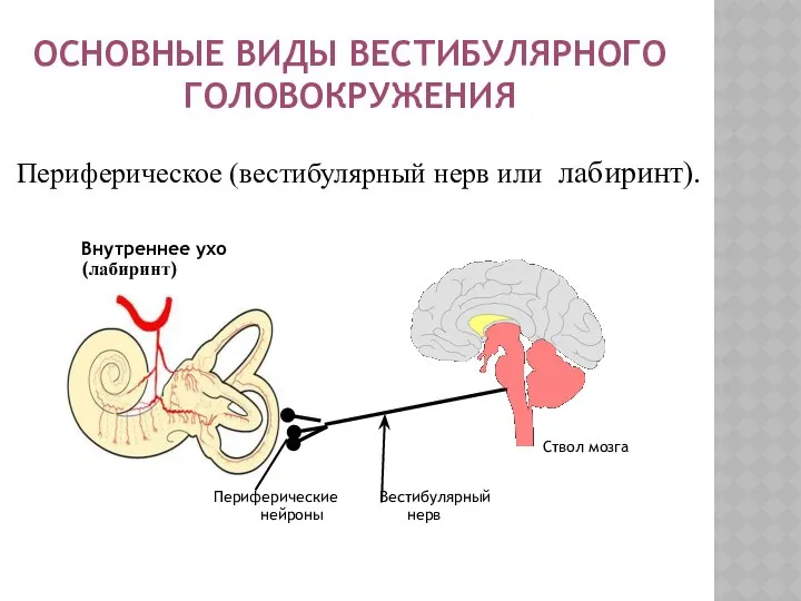 ОСНОВНЫЕ ВИДЫ ВЕСТИБУЛЯРНОГО ГОЛОВОКРУЖЕНИЯ Периферическое (вестибулярный нерв или лабиринт). Внутреннее ухо