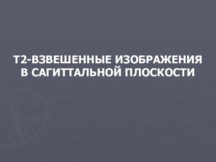 Т2-ВЗВЕШЕННЫЕ ИЗОБРАЖЕНИЯ В САГИТТАЛЬНОЙ ПЛОСКОСТИ