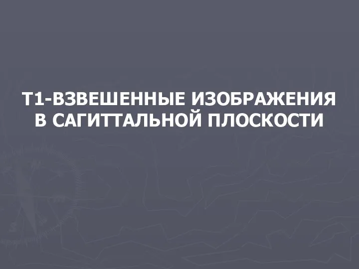 Т1-ВЗВЕШЕННЫЕ ИЗОБРАЖЕНИЯ В САГИТТАЛЬНОЙ ПЛОСКОСТИ