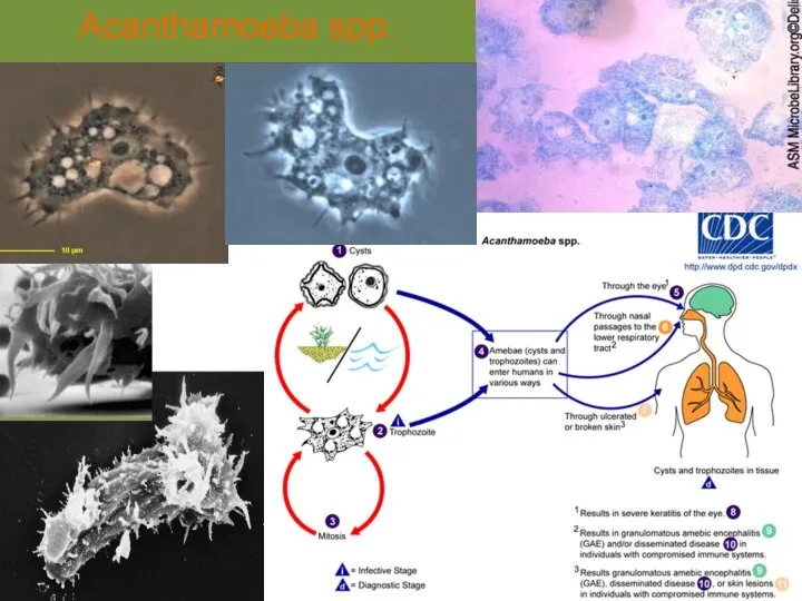 Acanthamoeba spp.