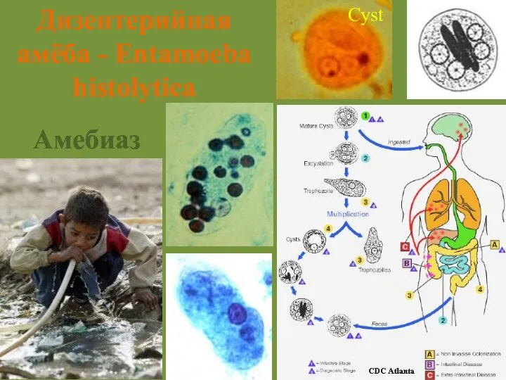 Амебиаз Cyst Дизентерийная амёба - Entamoeba histolytica