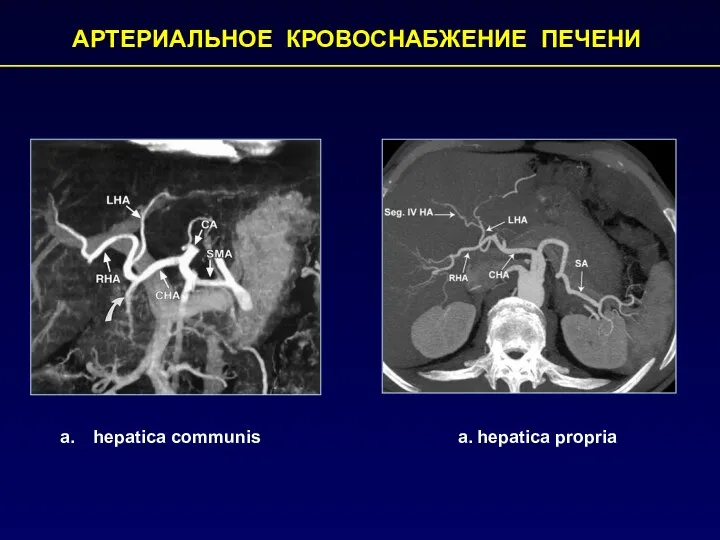 АРТЕРИАЛЬНОЕ КРОВОСНАБЖЕНИЕ ПЕЧЕНИ а. hepatica propria hepatica communis