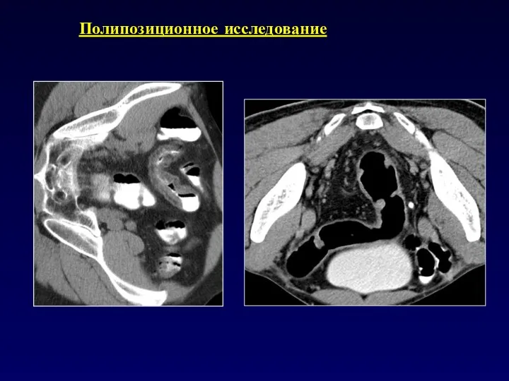 Полипозиционное исследование