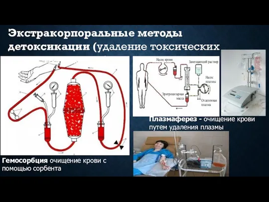 Гемосорбция очищение крови с помощью сорбента Плазмаферез - очищение крови путем