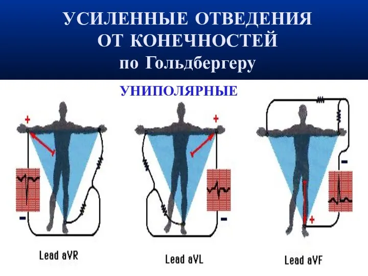 УСИЛЕННЫЕ ОТВЕДЕНИЯ ОТ КОНЕЧНОСТЕЙ по Гольдбергеру‏ УНИПОЛЯРНЫЕ