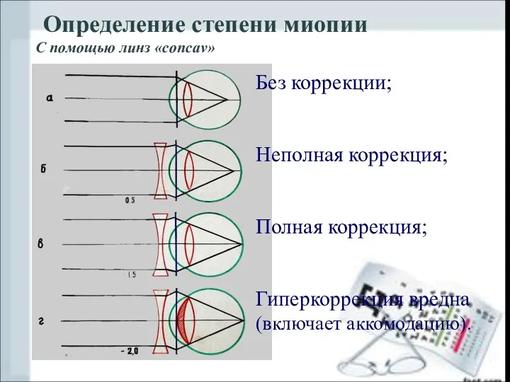 Определение степени миопии С помощью линз «concav» Без коррекции; Неполная коррекция;