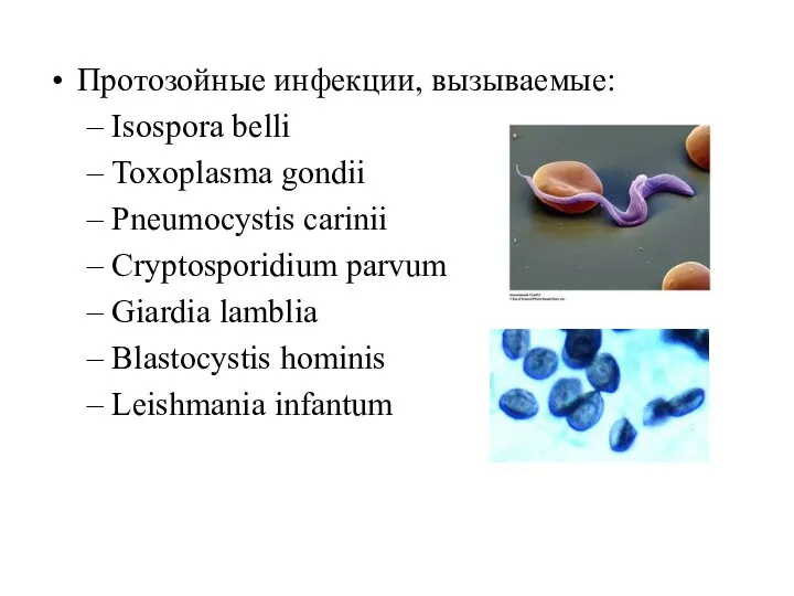 Протозойные инфекции, вызываемые: Isospora belli Toxoplasma gondii Pneumocystis carinii Сryptosporidium parvum