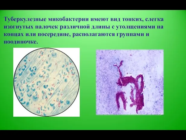 Туберкулезные микобактерии имеют вид тонких, слегка изогнутых палочек различной длины с