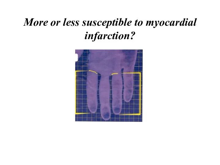 More or less susceptible to myocardial infarction?