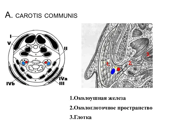A. carotis communis 1.Околоушная железа 2.Окологлоточное пространство 3.Глотка