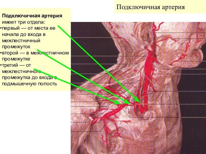 Подключичная артерия Подключичная артерия имеет три отдела: первый — от места