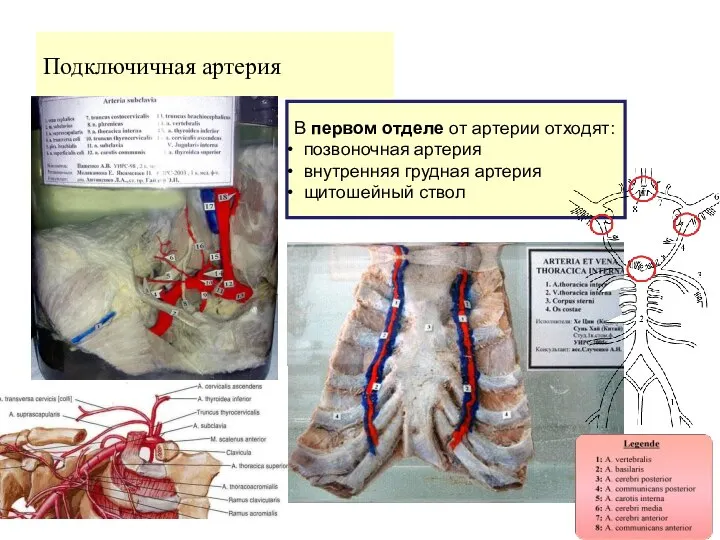 Подключичная артерия В первом отделе от артерии отходят: позвоночная артерия внутренняя грудная артерия щитошейный ствол