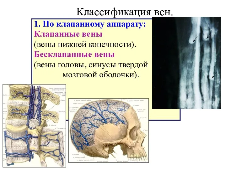 Классификация вен. 1. По клапанному аппарату: Клапанные вены (вены нижней конечности).