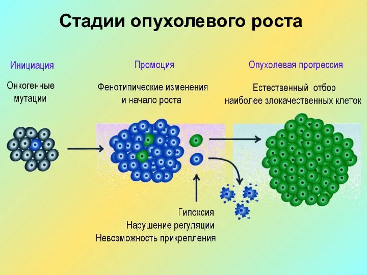 Стадии опухолевого роста