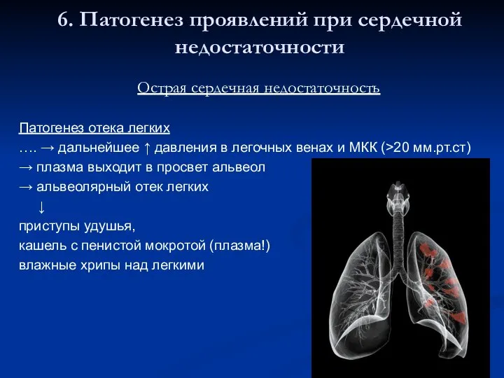 6. Патогенез проявлений при сердечной недостаточности Острая сердечная недостаточность Патогенез отека