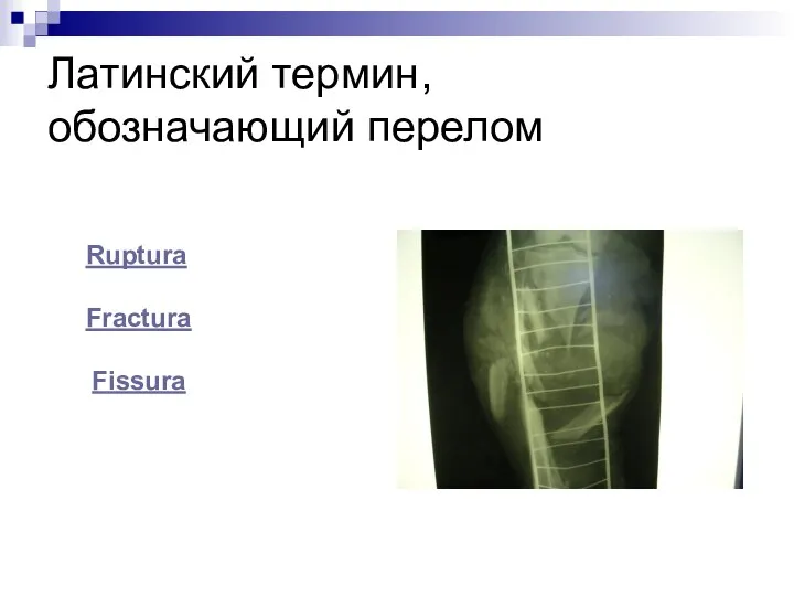 Латинский термин, обозначающий перелом Ruptura Fractura Fissura