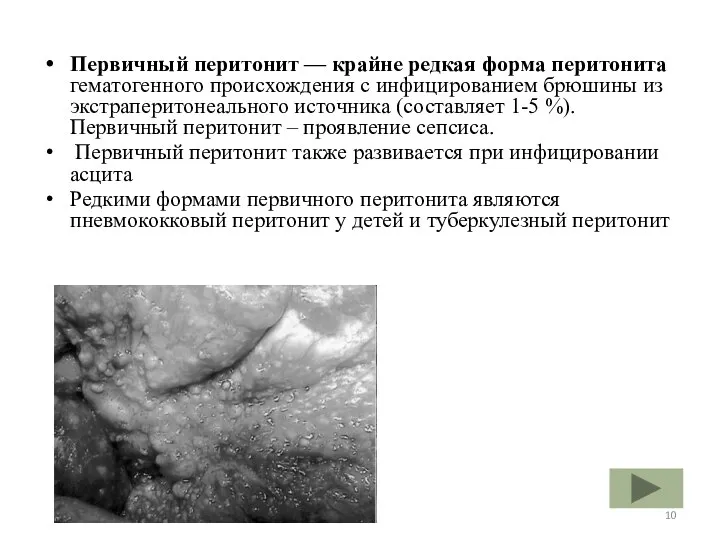 Первичный перитонит — крайне редкая форма перитонита гематогенного происхождения с инфицированием